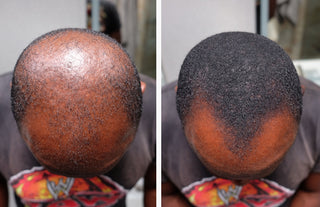 Before and After image of Darnell