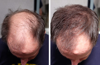 Before and After image of John