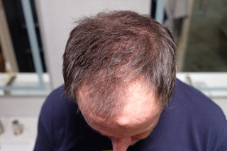 Customer John after using Tortoise and Hair fibers