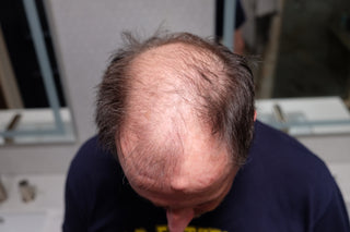 Customer John before using Tortoise and Hair fibers