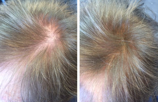 Before and After image of Kate