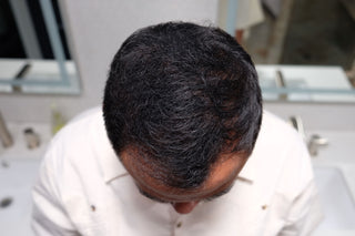 Customer Mario after using Tortoise and Hair fibers