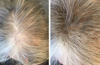 Before and After image of Sue