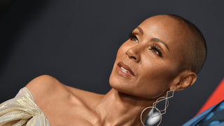 Does Jada Pinkett Smith Have Alopecia?