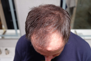Customer John after using Tortoise and Hair fibers